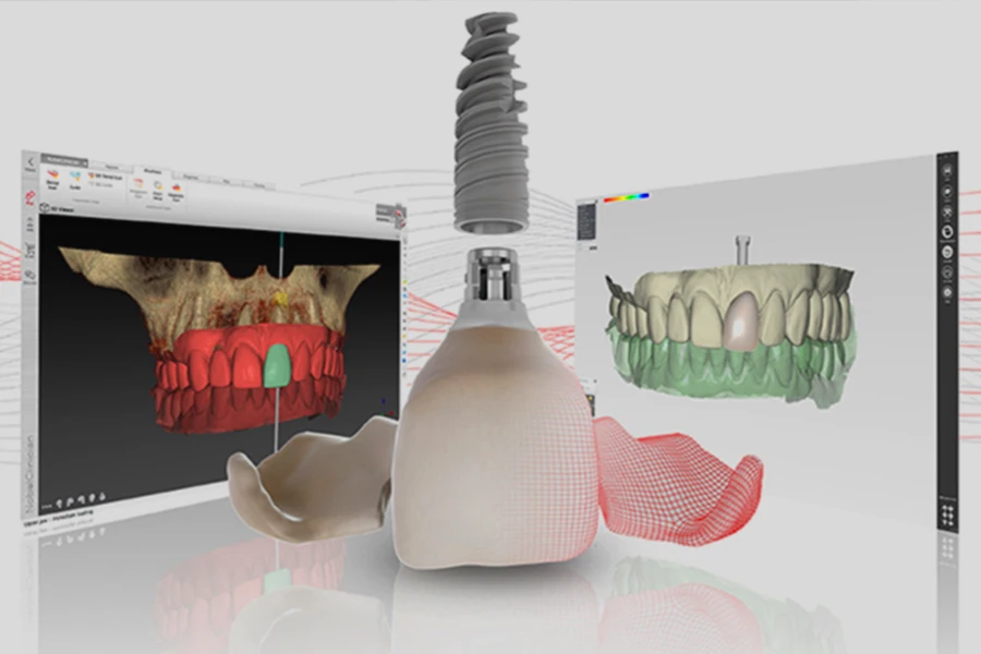 servizio odontoiatria digitale